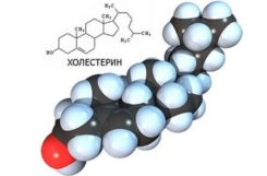 Холестерин 13: что это означает, и что делать при уровне 13.1-13.9 в крови? Холестерин 13: что это означает, и что делать при уровне 13.1-13.9 в крови?